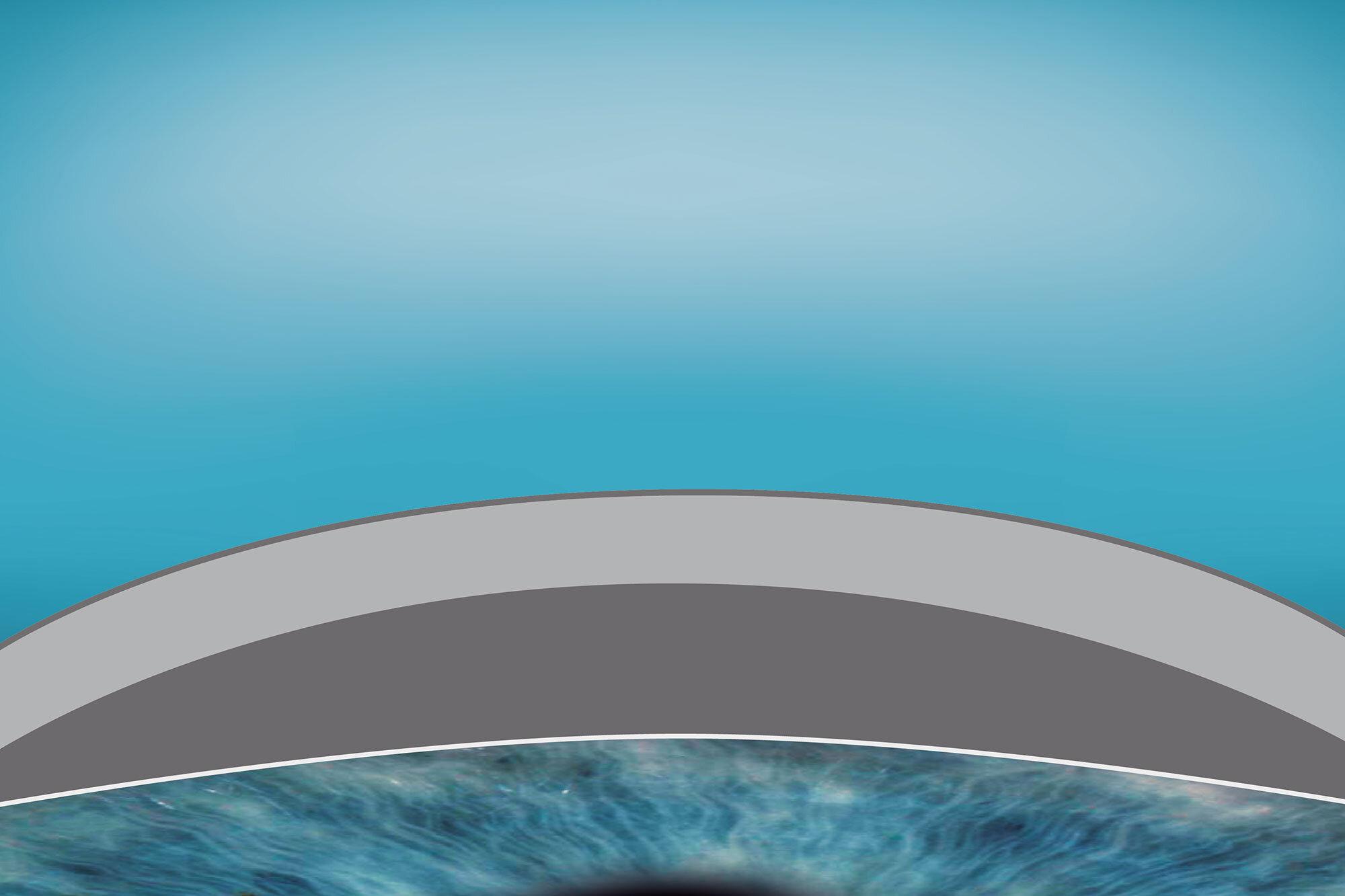 smartsurface-regular-cornea-01